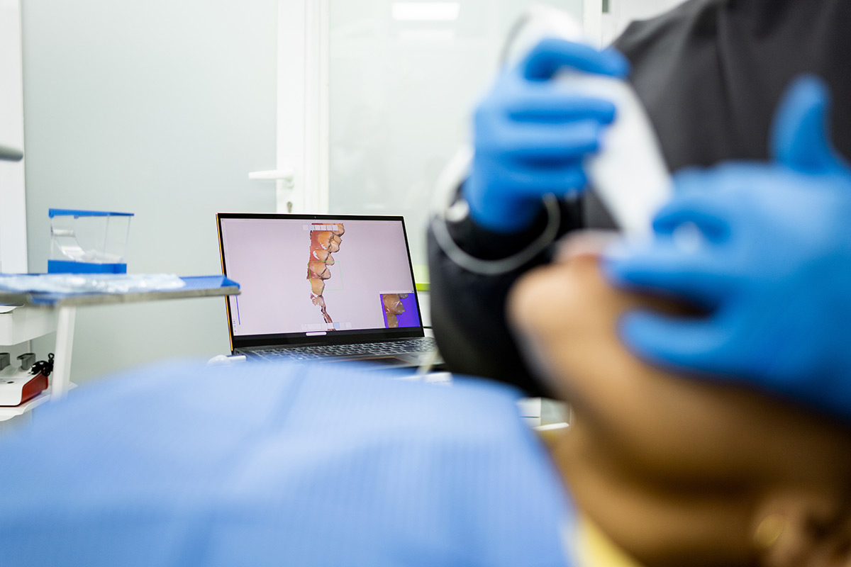 Dental implant model shown during restorative dental treatment