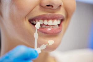 Porcelain Veneers: A Natural-Looking Way to Refresh Your Smile